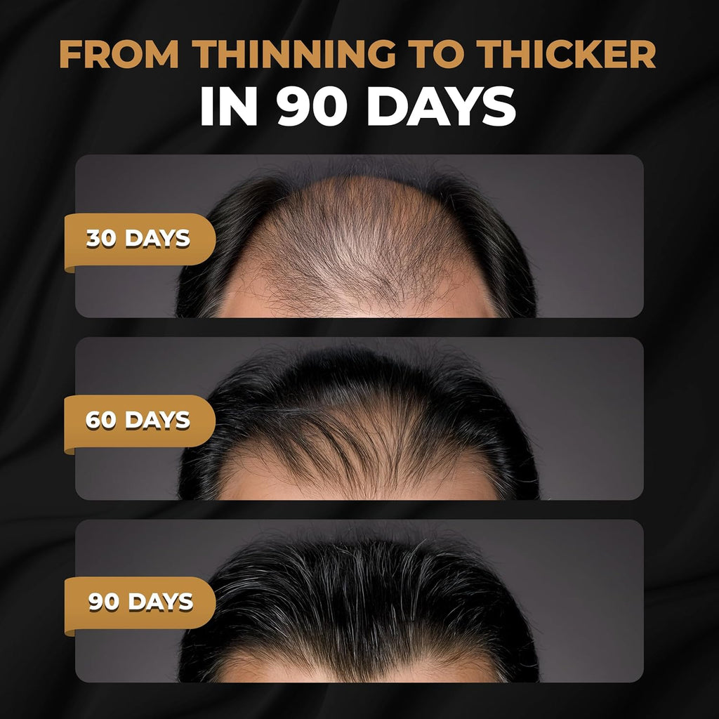 ™ Root Activator Shampoo for Men - Hair Growth Shampoo for Hair Loss and Thinning Hair